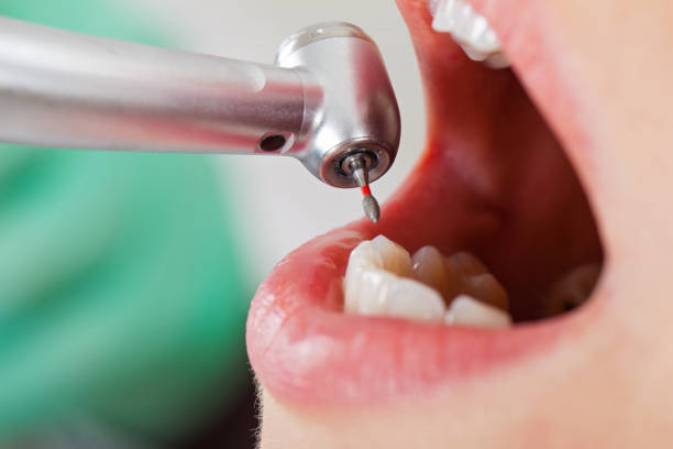 Best Tooth Pain Emergency Relief  in Pickens, MS